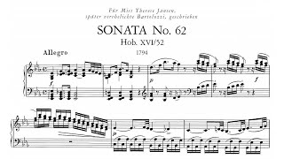 Haydn Sonata in E Flat major Hob XVI52  Wilhelm Backhaus 1959  London Treasury STS 15041 [upl. by Ilyssa951]