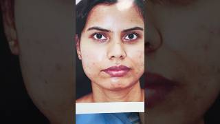 Best square or box shape face correction in india  golden ratio specialist [upl. by Sanjay22]