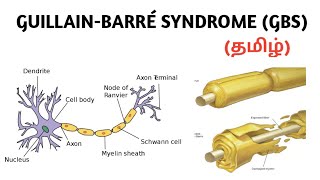 GuillainBarré syndrome  Causes  Symptoms  Diagnosis  Treatment  தமிழ் [upl. by Geri]