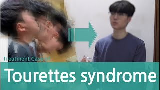 Tourettes Syndrome  Tic Disorder  voca tic  motor tic 틱 뚜렛 장애 치료사례 [upl. by Nomal369]