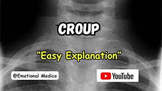 Croup  Acute LaryngoTracheoBronchitis  ENT  emotionalmedico [upl. by Haidebej]