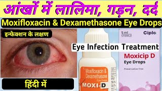 moxi d eye drops hindi  moxifloxacin and dexamethasone eye drops  moxicip eye drops in hindi [upl. by Ddej]