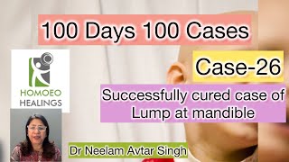 100 DAYS 100 CASES  DAY26  LUMP AT MANDIBLE NECK  DR NEELAM AVTAR SINGH  Video 198 [upl. by Polard]