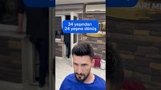 Saç protezi protez saç konyaprotezsaç protezsac barbershop sacekimi haircut sackesimi [upl. by Okun]