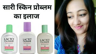 LACTO CALAMINE LOTION REVIEW IN HINDI FOR OILY amp DRY SKIN HOW TO APPLYUSE BENEFITS [upl. by Asenad]