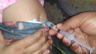 IM Intramuscular Arm injection PushPheniramine Meleate Avil 24 Ep 121 Anik Health Tips [upl. by Alake]