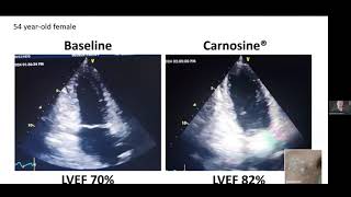 How Carnosine Benefits the Heart [upl. by Siahc]