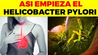 Helicobacter pylori diagnosis [upl. by Yael]