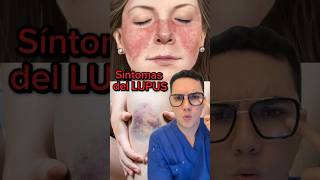 Síntomas de alerta de lupus que no debes ignorar  Dr William Guerrero medicina shorts ￼ [upl. by Ettennyl]