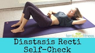 How To Test for Diastasis Recti [upl. by Haimehen46]