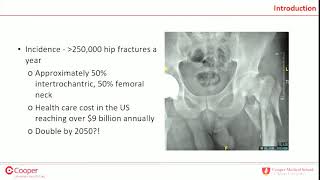 IM nail vs SHS for intertrochanteric femur fractures  debate [upl. by Iamhaj]