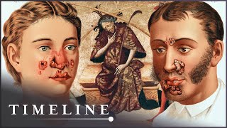 1495 Syphilis Outbreak The Deadly Disease That Swept Across Europe  The Syphilis Enigma  Timeline [upl. by Sitto]