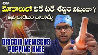 Knee pain amp Clicking  Discoid meniscus  Meniscal tear  Dr Ramprasad Kancherla [upl. by Hedges]