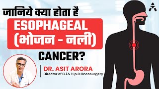 Esophageal Cancer Warning Signs You Should Never Ignore  Diagnosis amp Treatment  Dr Asit Arora [upl. by Averi85]