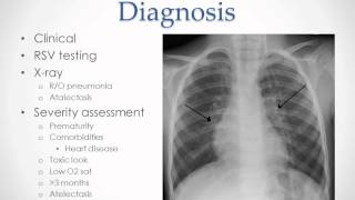 Bronchiolitis  USMLE Step 2 Review [upl. by Cherianne]