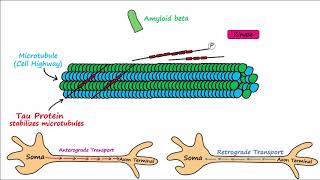 Alzheimers Disease  plaques tangles pathogenesis risk factors disease progression [upl. by Anaimad314]