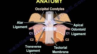 Occipital Condyle Fractures  Everything You Need To Know  Dr Nabil Ebraheim [upl. by Cressi]