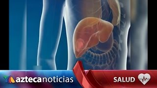 Ya es posible curar la hepatitis Conoce los procedimientos [upl. by Eilak]