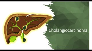 Cholangiocarcinoma [upl. by Nared]