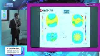 Dépistage précoce du kératocône  présentation du logiciel Score Analyzer [upl. by Ahseyd]