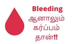 Implantation bleeding symptoms in tamil  implantation spotting identification  Puguntha veedu [upl. by Kwan500]