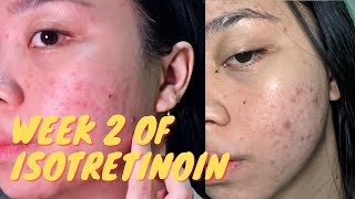 2 WEEKS AFTER TAKING ISOTRETINOIN Real updates  Purging is REAL pa rin [upl. by Reace]