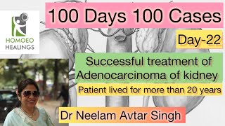 100 DAYS 100 CASES  DAY22 ADENOCARCINOMA OF KIDNEY  DR NEELAM AVTAR SINGH  VIDEO 194 [upl. by Joye]