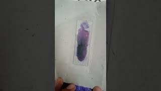 Peripheral Blood Smear for determining Differential Leucocyte count [upl. by Siroled]