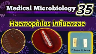 Haemophilus influenzae شرح بالعربي [upl. by Ericksen]