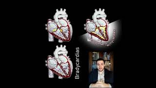 Regular vs Irregular Supraventricular Tachycardias 🫀⚡ Shorts [upl. by Flieger171]