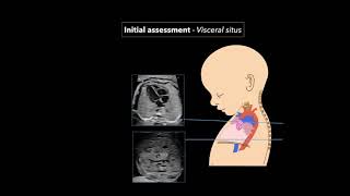 Fetal Echocardiography Protocol and Technique [upl. by Ettesus892]