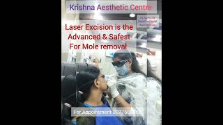 Do you know moles occur due to human Papilloma Virus  Contact your Doctor soonmoleremoval [upl. by Libove]