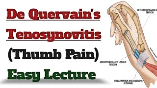 What is De Quervains TenosynovitisHow can we treat itExercises for Thumb Pain Relief [upl. by Marcelle256]