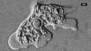 How dangerous are brain eating amoeba [upl. by Ardnuyek530]