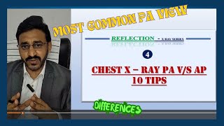 CHEST X RAY PA VS AP VIEW 10 DIFFERENCES  REFLECTION 4 [upl. by Liuqa]