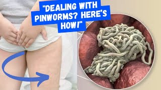 Pinworms Diagnosis Treatment and Prevention Tips [upl. by Avan]