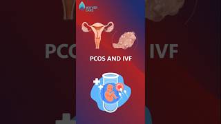 Is IVF Possible In PCOS  Dr Supriya Puranik ivfinpcos mothercare drsupriyapuranik ivf iui [upl. by Elyrpa]