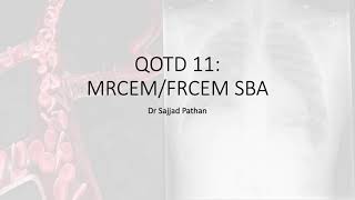 Question of the Day 11 MRCEMFRCEM SBA SLO1 Sickle Cell Disease [upl. by Nimar]