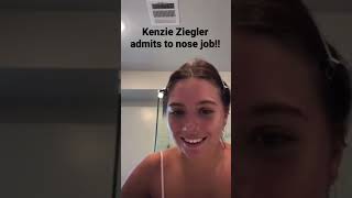 Kenzie Ziegler confirms nose job kenzieziegler dancemoms [upl. by Annabel]