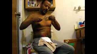 How to change ileostomy or colostomy bag [upl. by Reklaw11]