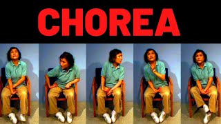 WHAT IS CHOREA Symptoms Causes Treatment [upl. by Coad589]