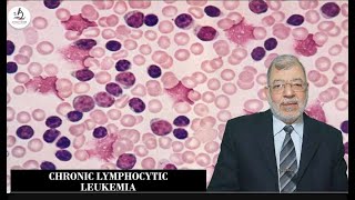 Chronic lymphocytic Leukemia Part 1 [upl. by Yebloc768]