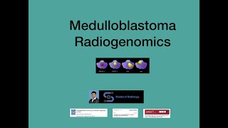 Medulloblastoma Radiogenomics Simplified [upl. by Boyt491]