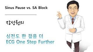 심전도 한 걸음 더 11 Sinus pause 동정지 Sinoatrial block SA block 동방차단 [upl. by Henn]