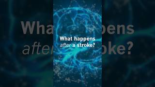 What happens after a stroke [upl. by Lehsar]