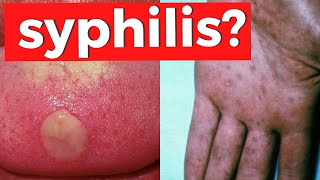 SYPHILIS  Everything You Need To Know about Treponema Pallidum [upl. by Wilkinson]