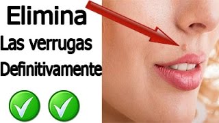 Tips antiverrugas Elimina Las Verrugas Solamente Usando Vaselina Con Vinagre De Sidra De Manzana [upl. by Nolrak]