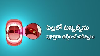 Causes and Cures for Tonsillitis and Adenoiditis in Children in Telugu  టాన్సిల్స్ వాపు [upl. by Niltag]