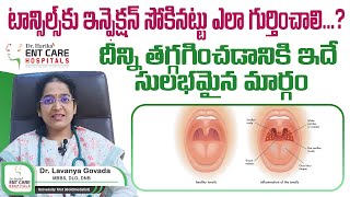 టాన్సిల్స్‌ ఎలా గుర్తించాలి  Tonsillitis  Symptoms Causes  Dr Harika ENT Care Hospital [upl. by Zinah]