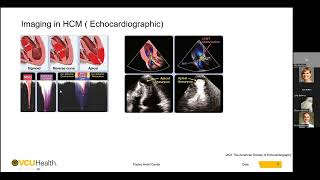 Imaging in Hypertrophic Cardiomyopathy  Mohammed Makkiya MD [upl. by Anomahs]